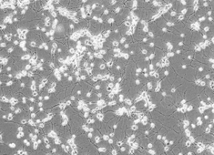 OriCell™ SD Fetal Rat Hippocampal Neurons-SHCFN-00001