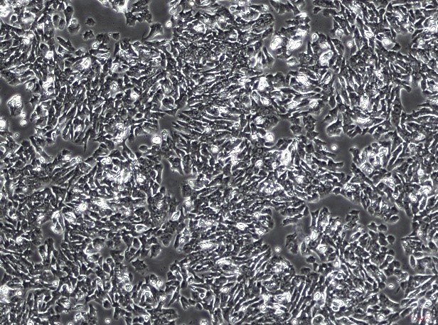 OriCell™ Y1 Mouse Adrenocortical Tumor Cell Line
